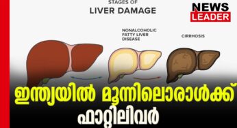 നോണ്‍ ആല്‍ക്കഹോളിക് ഫാറ്റിലിവര്‍ ഏറുന്നു